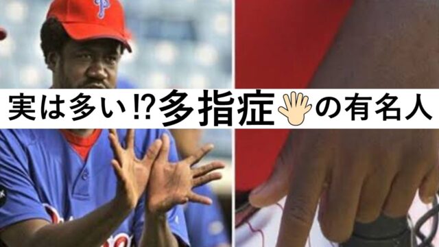 【指が6本】多指症の有名人/芸能人22選!小栗旬も多指症だと話題に? | K-Journal
